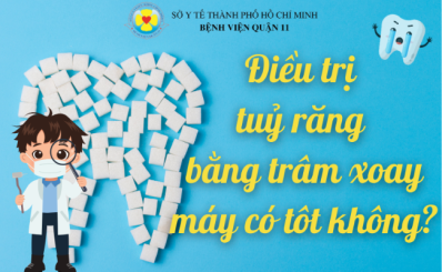 Điều trị tuỷ răng bằng trâm xoay máy có tôt không?